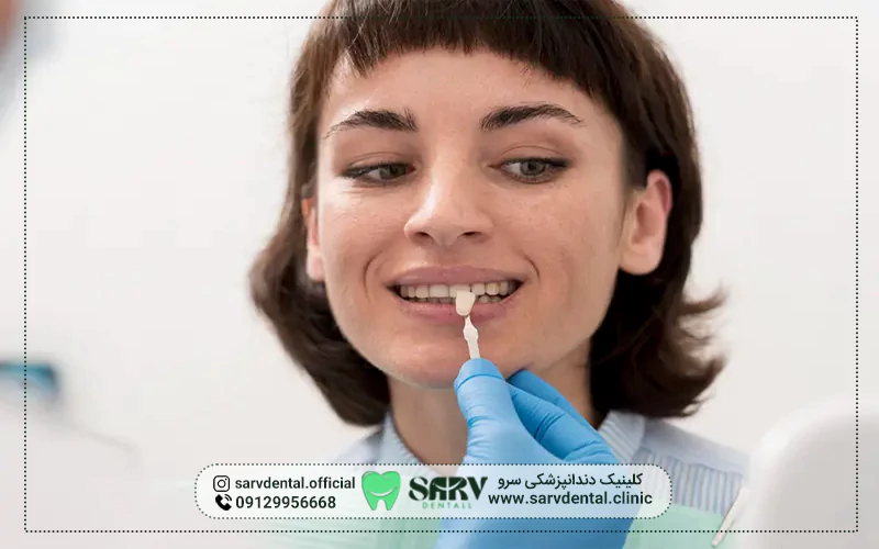 آیا لمینت دندان روکش شده امکان پذیر است؟
