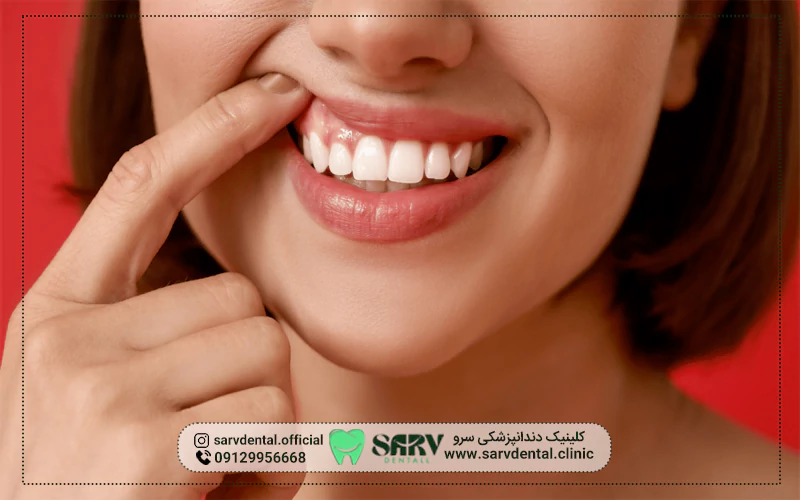 عوامل بوی ناخوشایند دهان