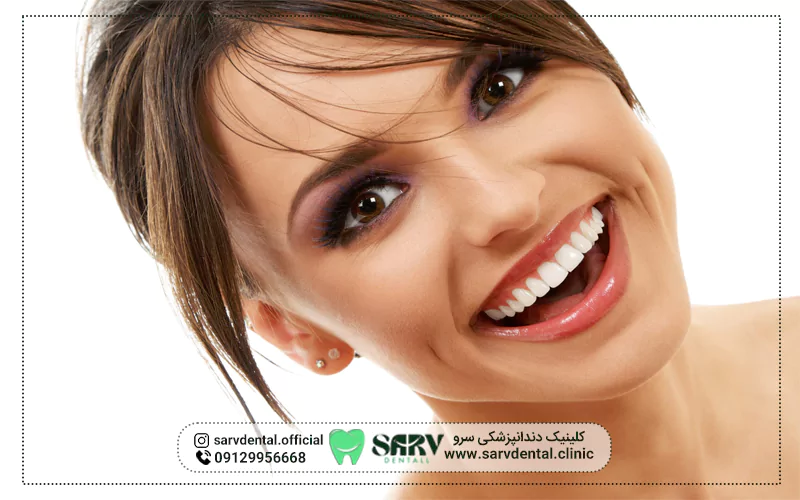 معایب کامپوزیت دندان 