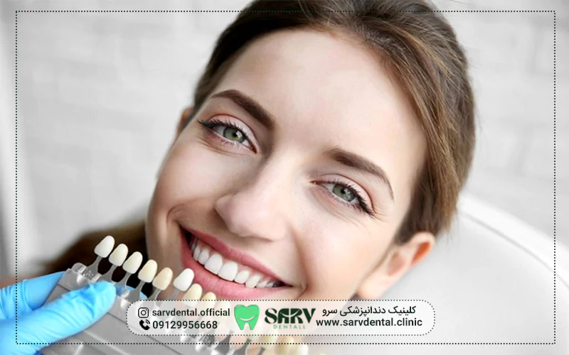 بهترین جایگزین برای لمینت دندان در سنین پایین 