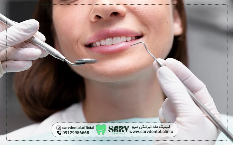 ویژگی‌های بهترین دکتر لمینت دندان در تهران