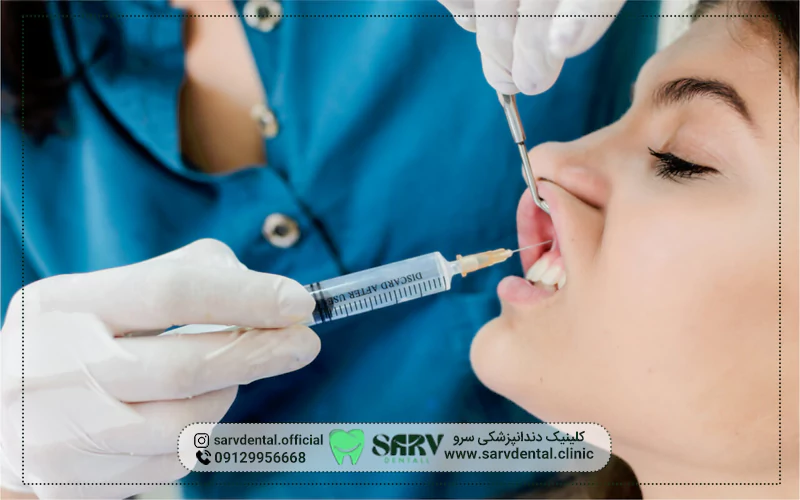 موارد خاص بی حس کردن دندان برای کامپوزیت