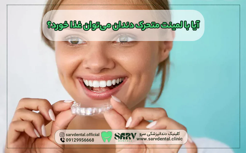 آیا با لمینت متحرک دندان می ‌توان غذا خورد؟