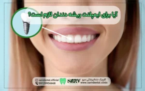 آیا برای ایمپلنت ریشه دندان لازم است؟