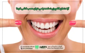 دندان کامپوزیت شده را می توان عصب کشی کرد؟