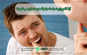 آیا کامپوزیت باعث جلو آمدن دندان‌ می‌شود؟