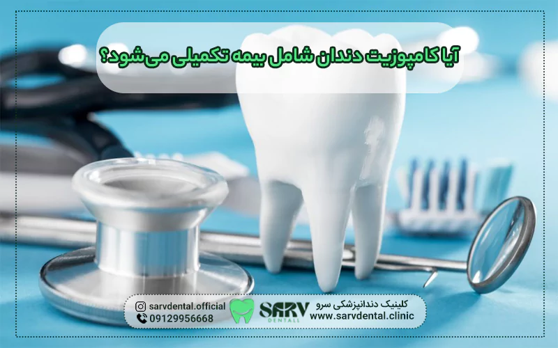 آیا کامپوزیت دندان شامل بیمه تکمیلی می شود؟