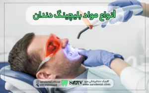 انواع مواد بلیچینگ دندان