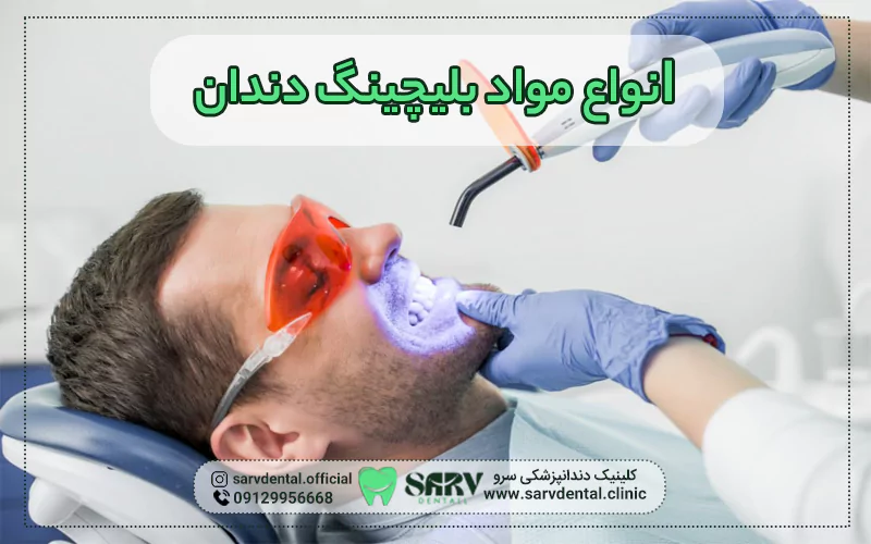 انواع مواد بلیچینگ دندان