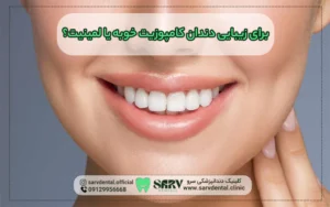 برای زیبایی دندان کامپوزیت خوبه یا لمینت؟