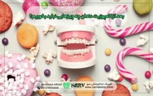 بعد از کامپوزیت دندان چه چیزهایی نباید بخوریم؟