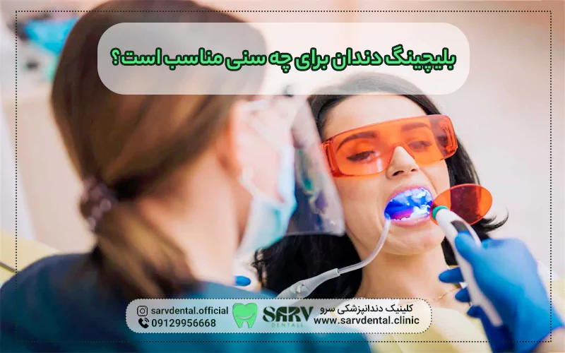 بلیچینگ دندان برای چه سنی مناسب است؟