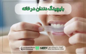 بلیچینگ دندان در خانه