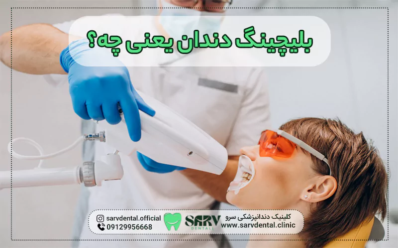 بلیچینگ دندان یعنی چه؟