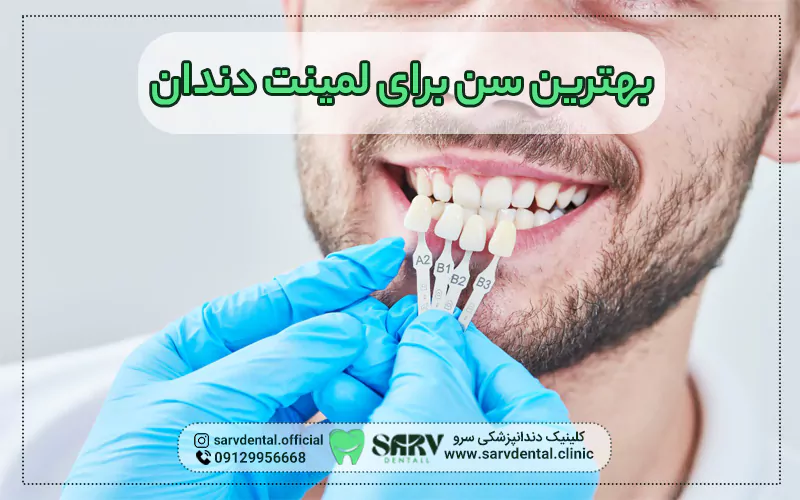 بهترین سن برای لمینت دندان