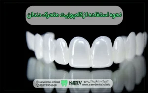 نحوه استفاده از کامپوزیت متحرک دندان