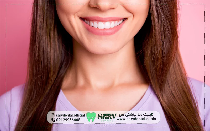 آیا بیمه‌ تکمیلی تمام هزینه‌ لمینت دندان را پوشش می‌دهد؟