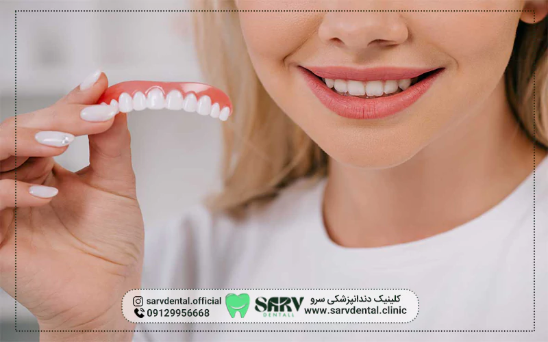 مزایای استفاده از دندان مصنوعی ثابت بر پایه ایمپلنت