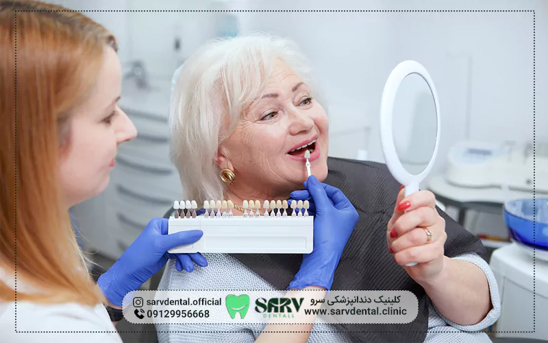 روشهای جایگزین کامپوزیت دندان مصنوعی