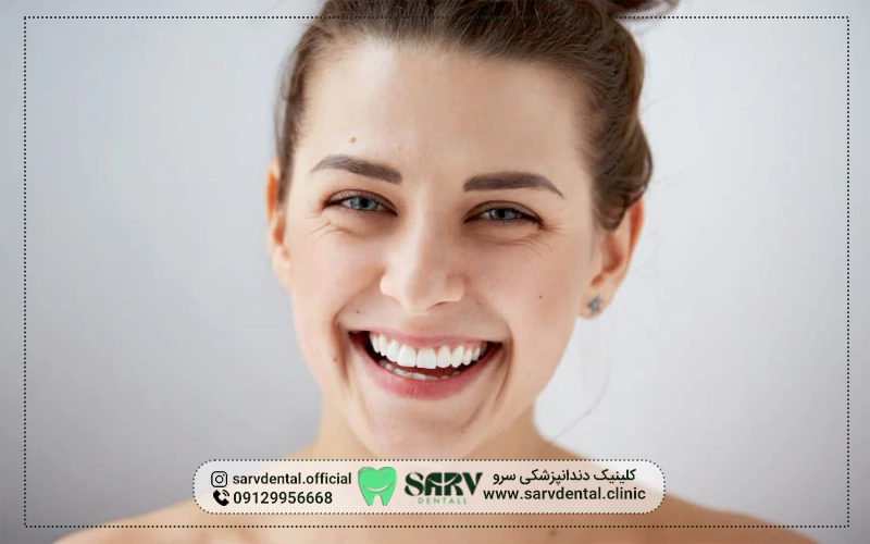 لمینت چیست؟