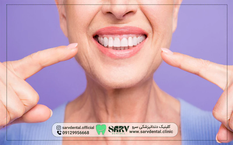 کامپوزیت دندان برای چه کسانی مناسب نیست؟