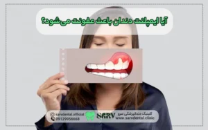 آیا ایمپلنت دندان باعث عفونت می شود؟