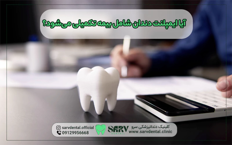 ایمپلنت دندان شامل بیمه تکمیلی می‌شود؟