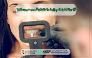 برداشتن کامپوزیت به دندان آسیب می رساند؟