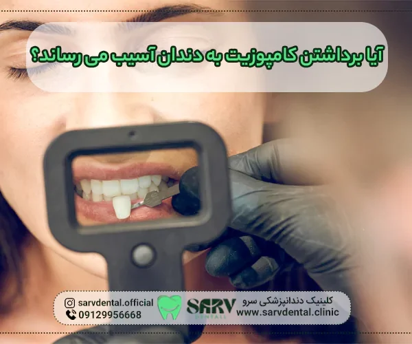 برداشتن کامپوزیت به دندان آسیب می رساند؟