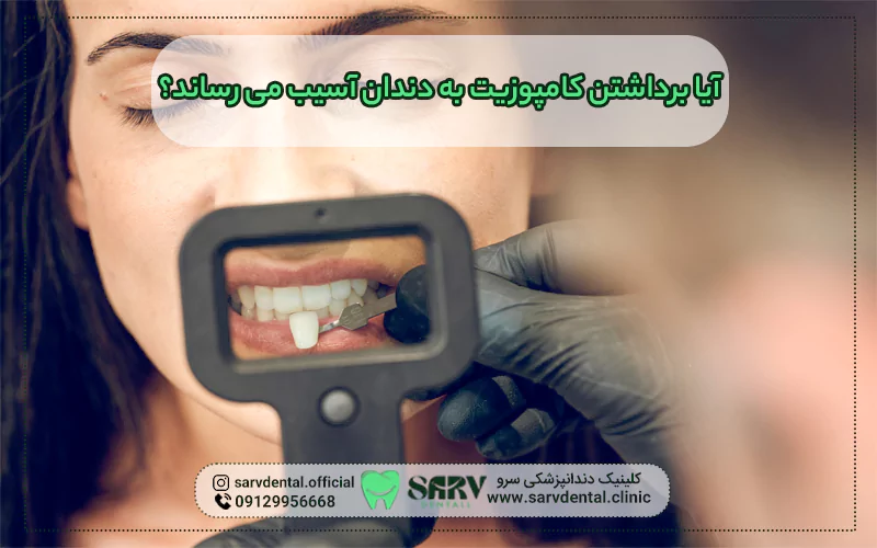 برداشتن کامپوزیت به دندان آسیب می رساند؟