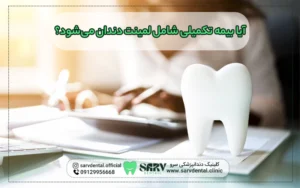 بیمه تکمیلی شامل هزینه لمینت دندان می شود؟