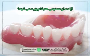 دندان مصنوعی هم کامپوزیت می شود؟