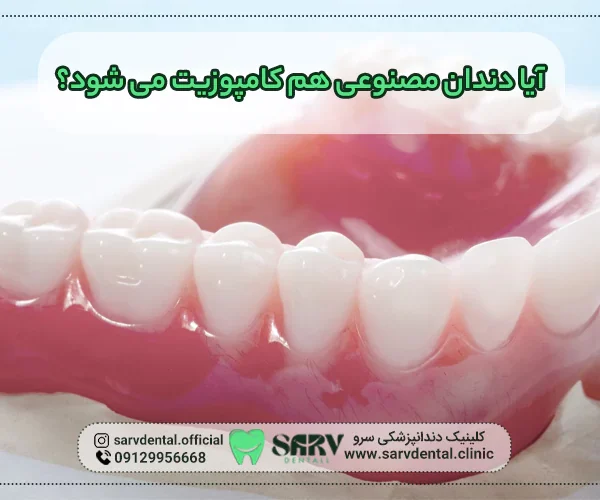 دندان مصنوعی هم کامپوزیت می شود؟