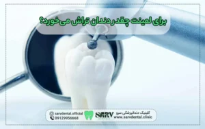 برای لمینت چقدر دندان تراش می خورد؟