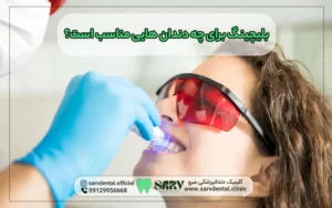 بلیچینگ برای چه دندان هایی مناسب است؟