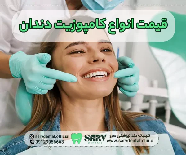 قیمت انواع کامپوزیت دندان