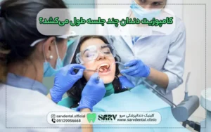 کامپوزیت دندان چند جلسه طول می کشد؟