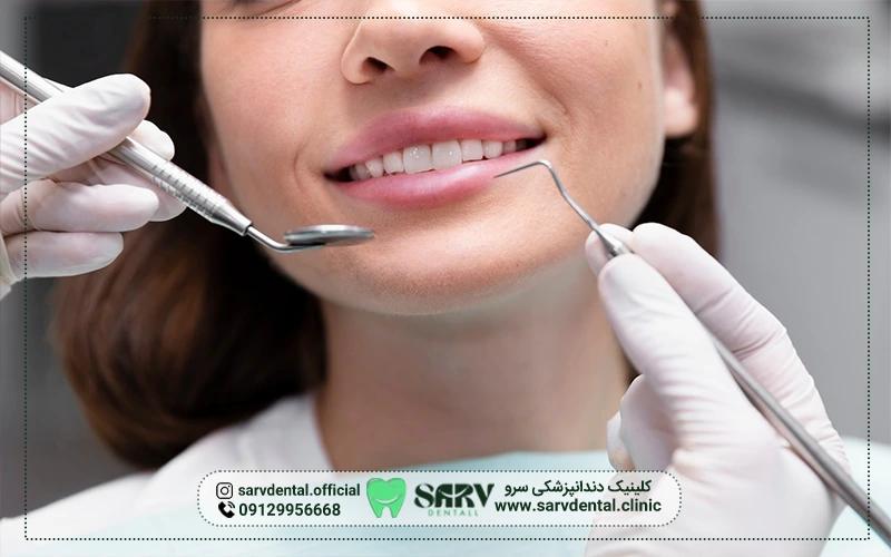 لمینت برای چه دندان هایی مناسب است؟