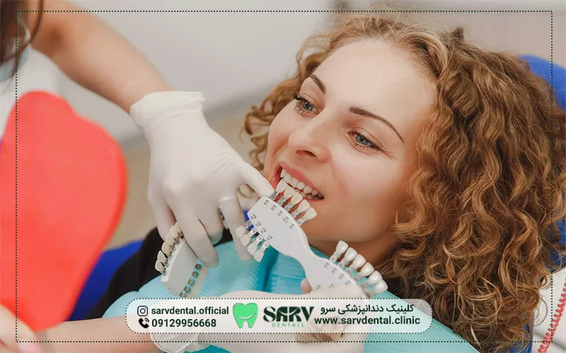 مزایای بهترین کلینیک کامپوزیت دندان در تهران