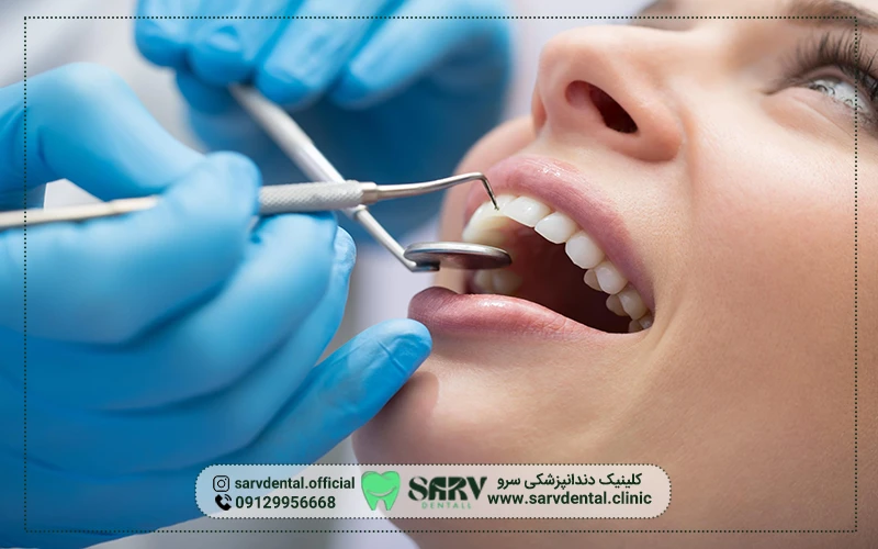 ویژگی های بهترین کلینیک ایمپلنت دندان در تهران