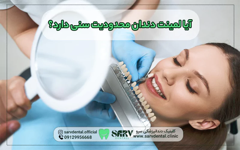 آیا لمینت دندان محدودیت سنی دارد؟