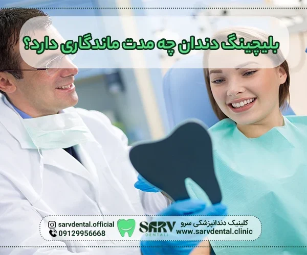 بلیچینگ دندان چه مدت ماندگاری دارد؟