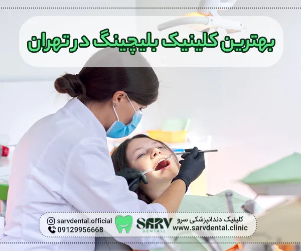 بهترین کلینیک بلیچینگ در تهران
