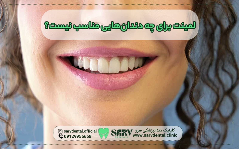 لمینت برای چه دندان هایی مناسب نیست؟