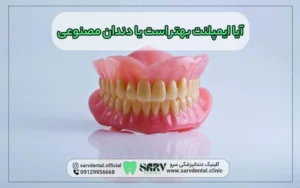 ایمپلنت بهتر است یا دندان مصنوعی؟