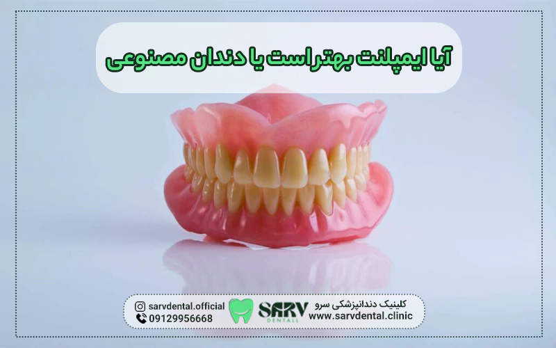 ایمپلنت بهتر است یا دندان مصنوعی؟
