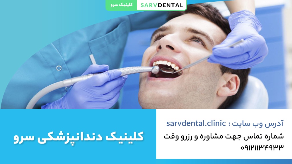 بهترین مرکز تخصصی کامپوزیت دندان در تهران
