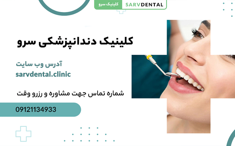composite teeth jordan tehran sarv clinic 2