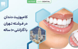 کامپوزیت دندان طبیعی و زیبا در فرشته تهران با بهترین دندانپزشک زیبایی