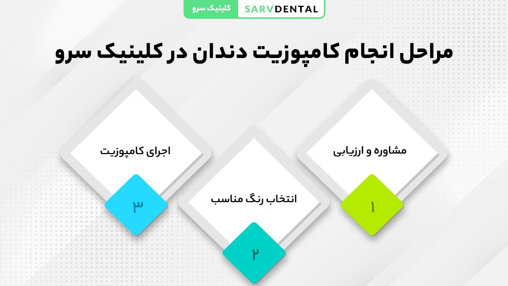 مراحل گامبهگام انجام کامپوزیت دندان از معاینه تا پرداخت نهایی
